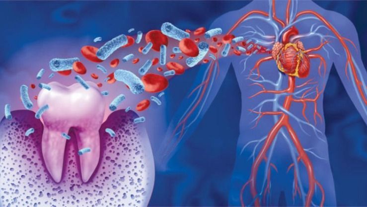 تأثير تناول السكر على صحة الفم والقلب علامات تحذيرية وعلاقة بين التهاب اللثة وأمراض القلب